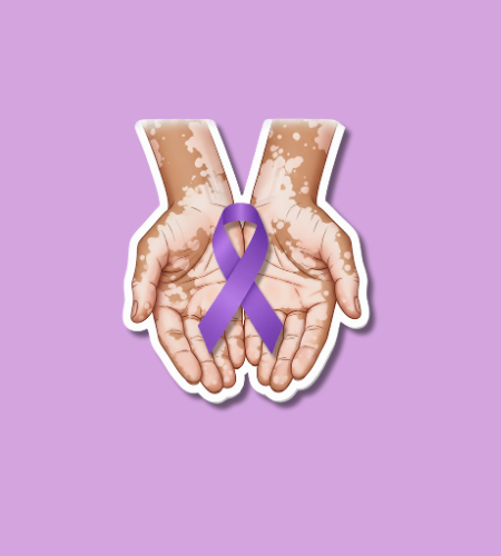 World Vitiligo Day