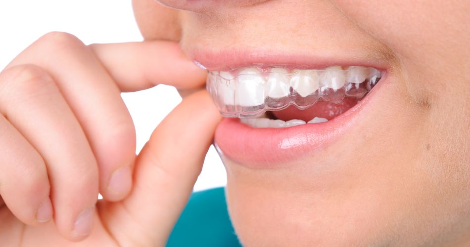 Retainer